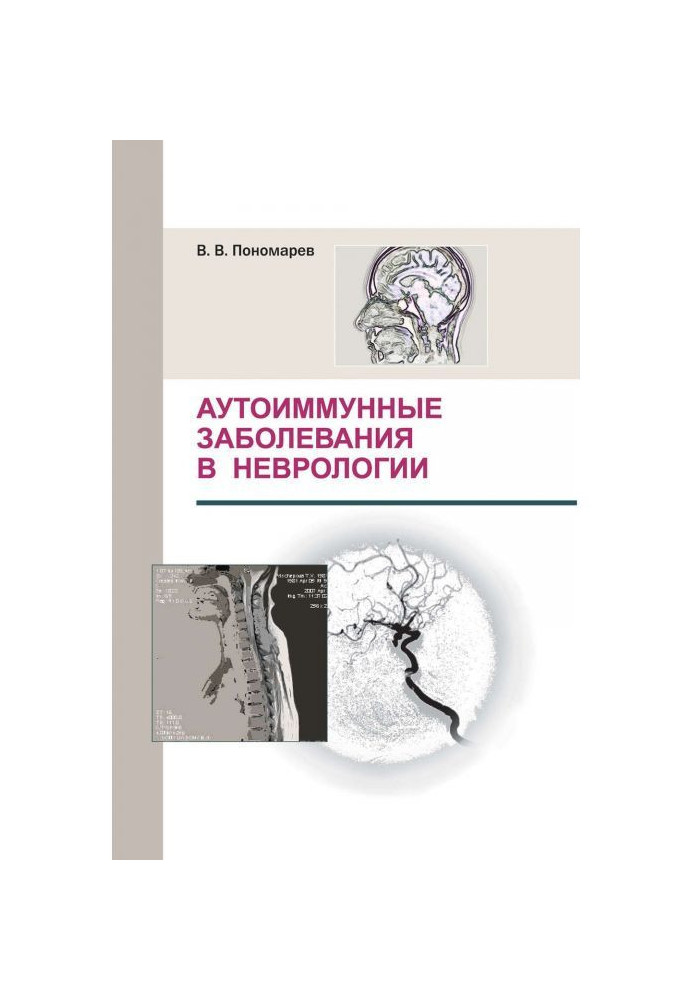 Book Autoimmune diseases are in neurology