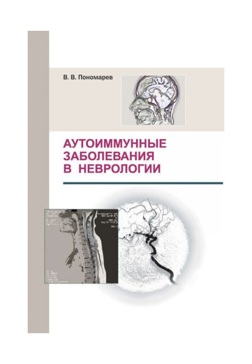 Книга Аутоіммунні захворювання в неврології