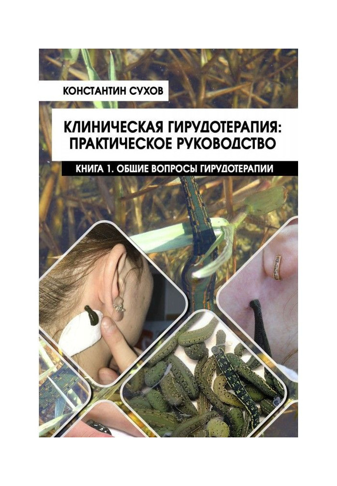 Книга Клиническая гирудотерапия: практическое руководство. Книга 1. Общие вопросы гирудотерапии