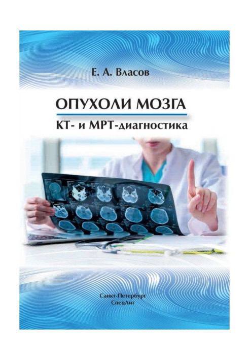 Book brain tumors. CT and MRI diagnostics
