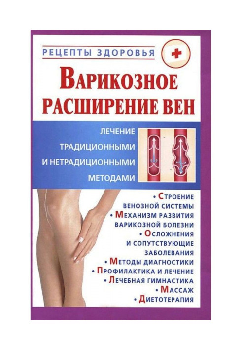 Book Phlebeurysm. Treatment traditional and unconventional methods