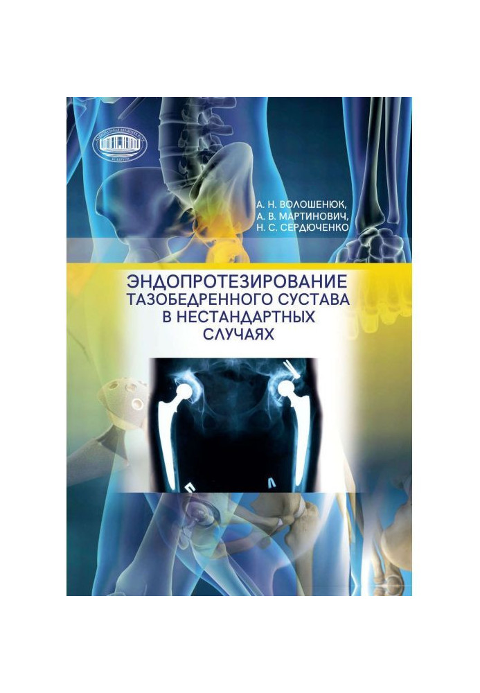 Book Endoprosthetics of the hip joint in non-standard cases