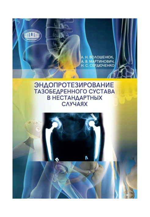 Книга Эндопротезирование тазобедренного сустава в нестандартных случаях
