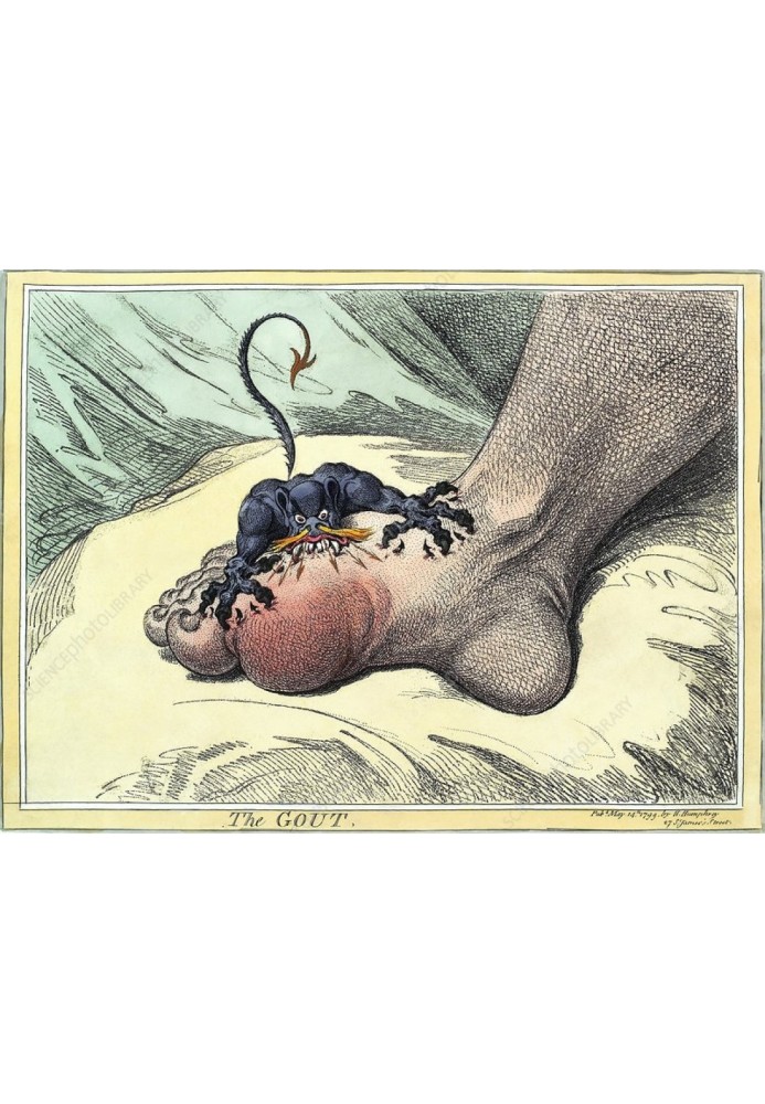 Book How to fight gout