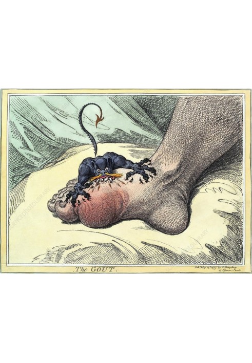 Book How to fight gout