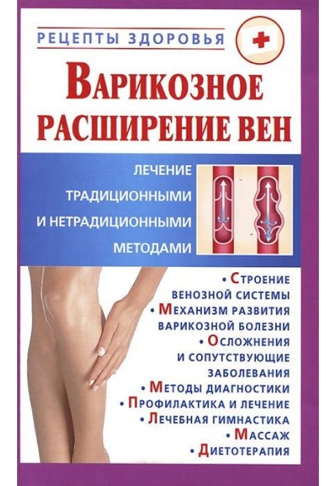 Книга Варикозне розширення вен.
