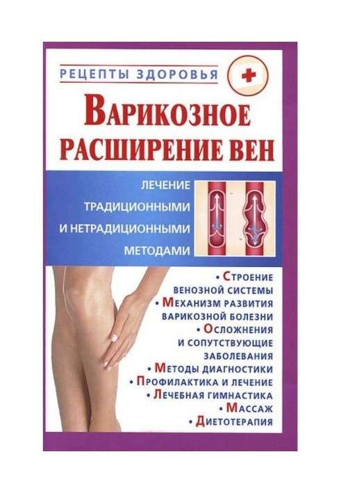 Book Phlebeurysm. Treatment traditional and unconventional methods