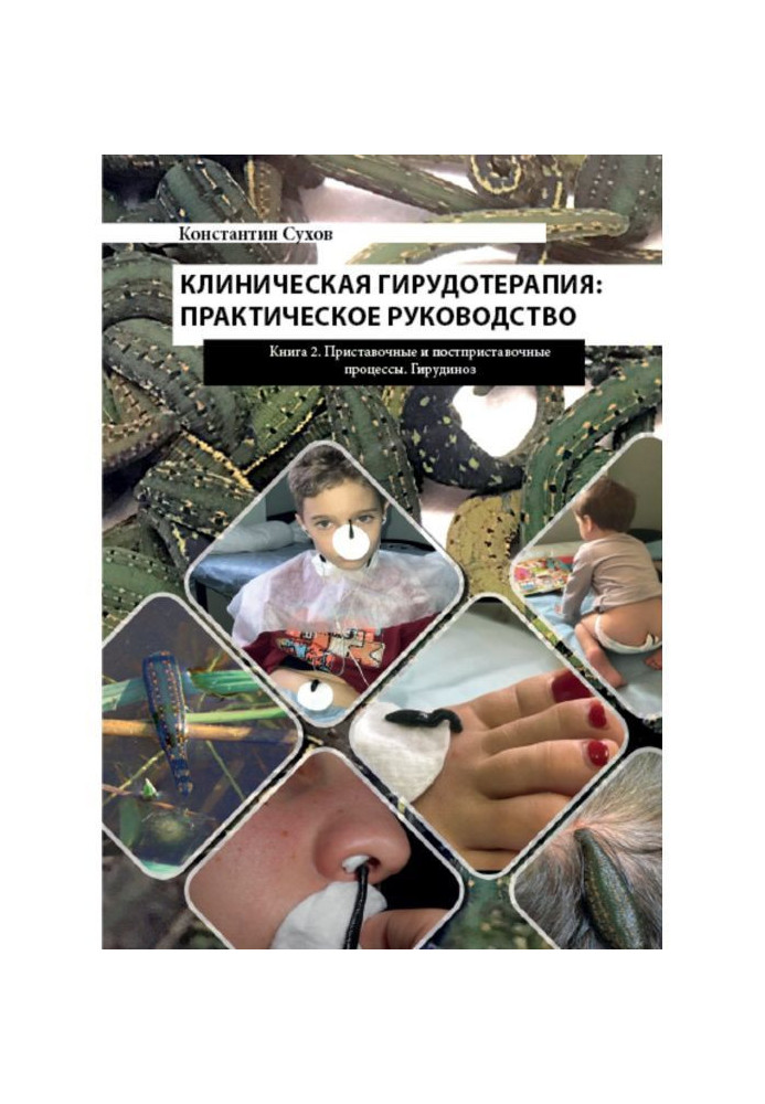 Книга Клиническая гирудотерапия: практическое руководство. Книга 2 Приставочные и постприставочные процессы. Гирудиноз