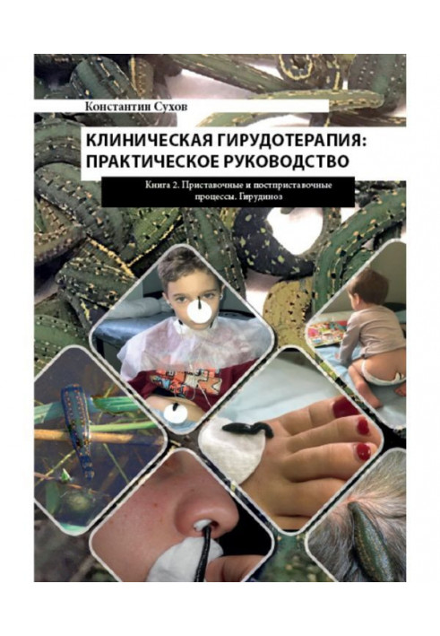 Книга Клиническая гирудотерапия: практическое руководство. Книга 2 Приставочные и постприставочные процессы. Гирудиноз